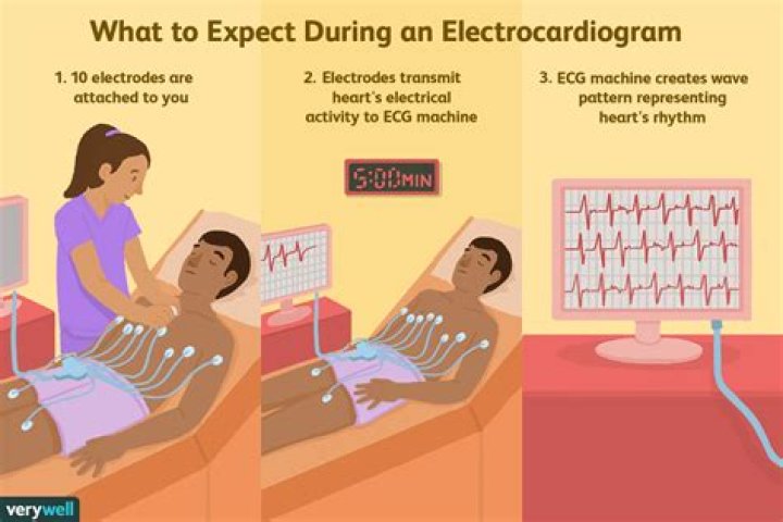 Do you need to fast before an electrocardiogram?