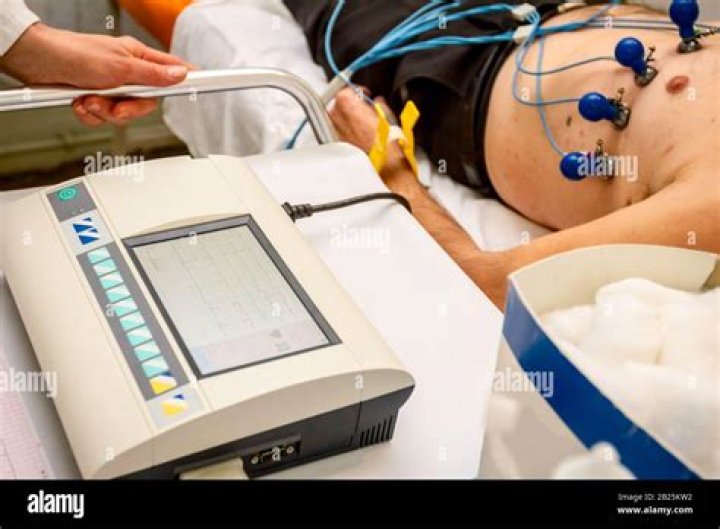 How electrocardiogram machine works?