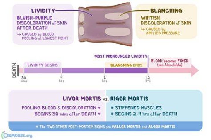 Is it livor mortis or rigor mortis?